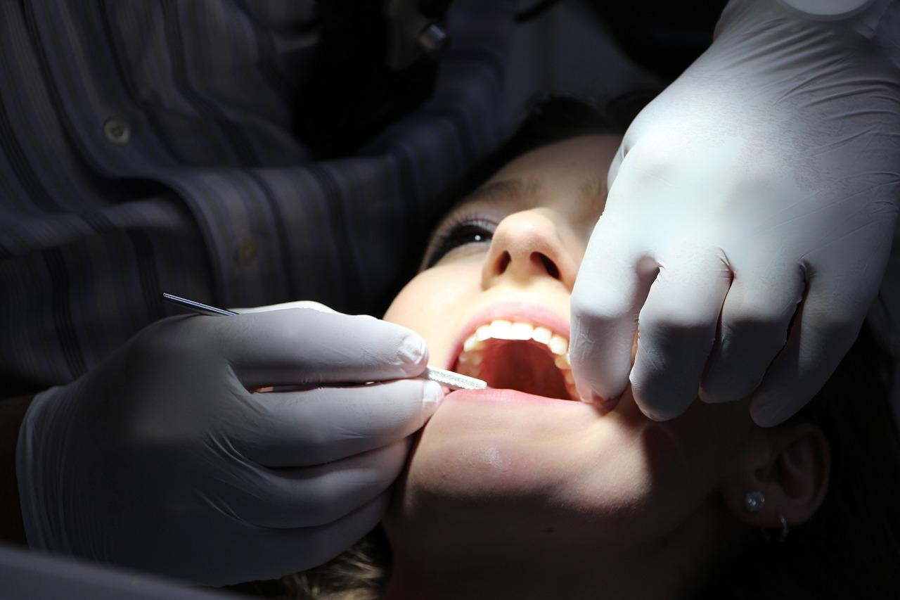 Kiedy zakładany jest opatrunek na zęba?